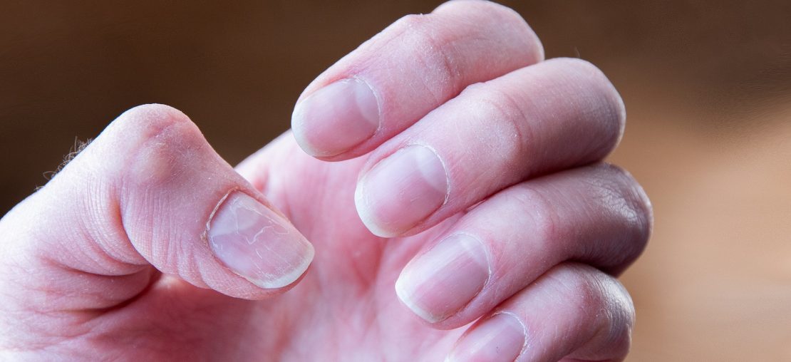 Fortalecer as Unhas